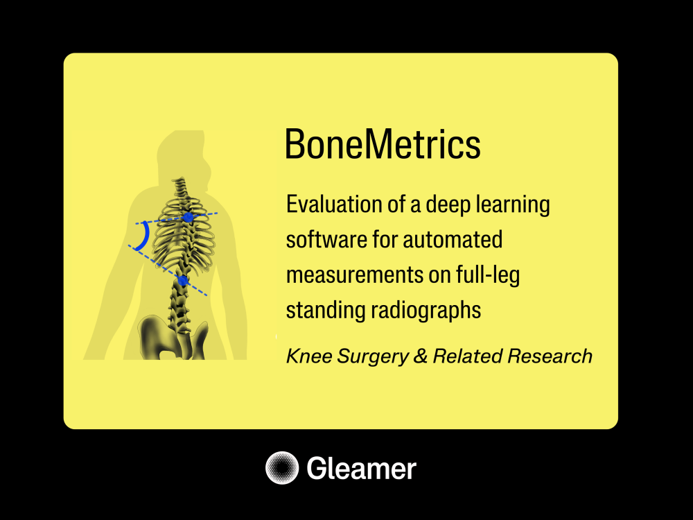Bonemetrics Ksrr