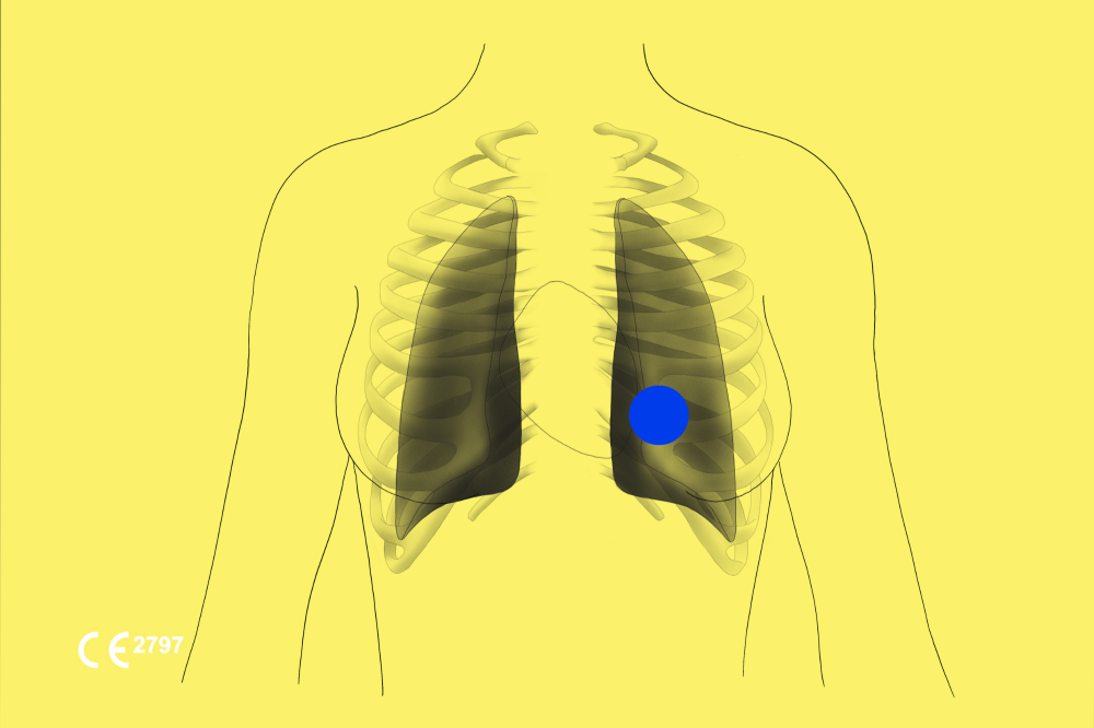 Chestview Ai