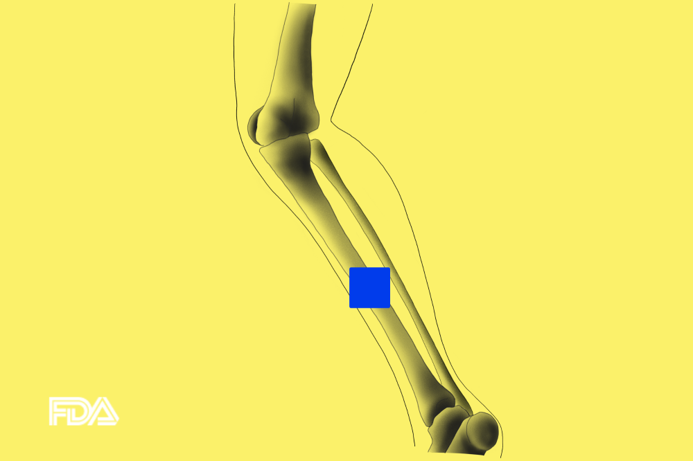Boneview FDA
