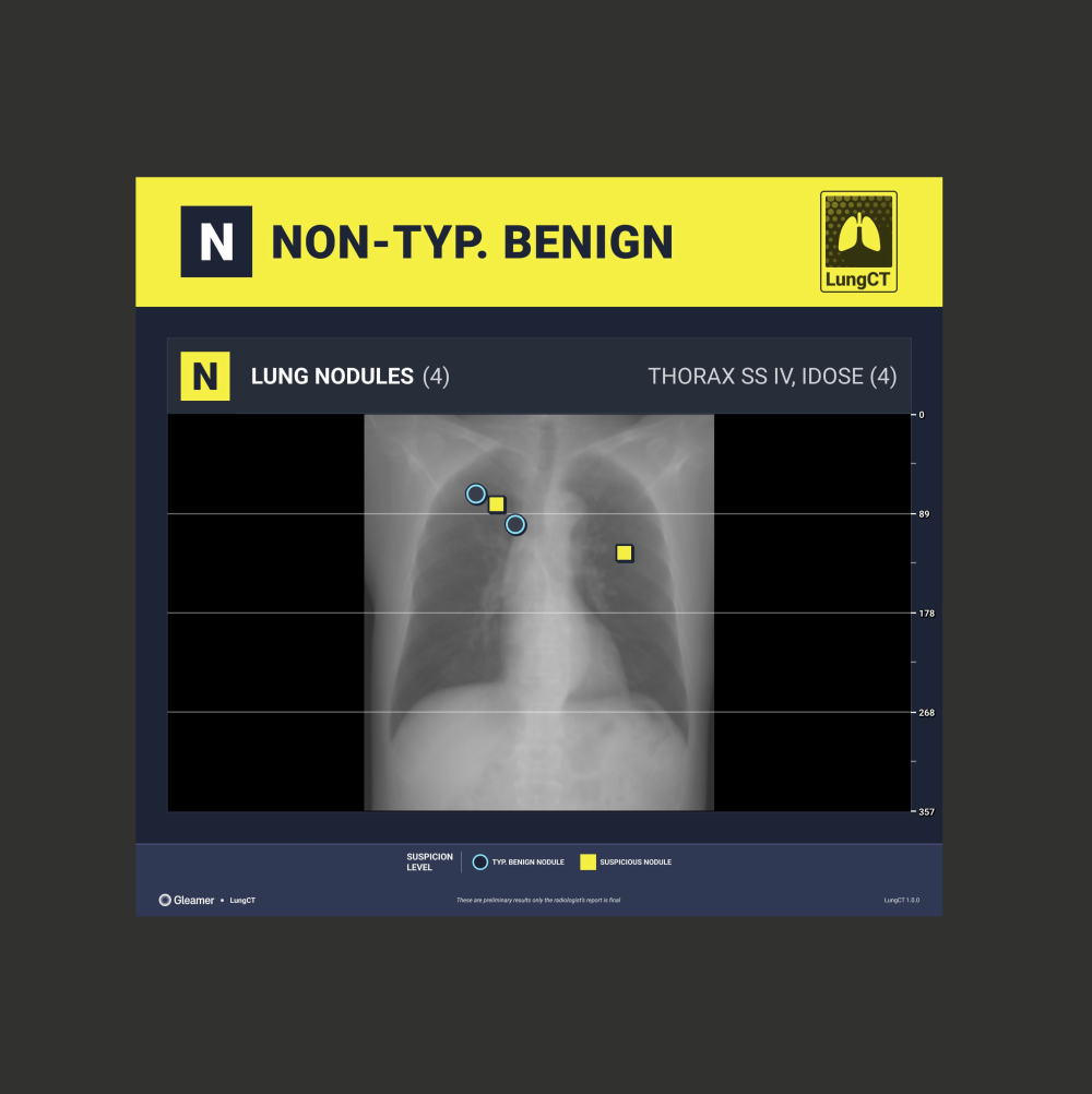 Lungct Summary Website