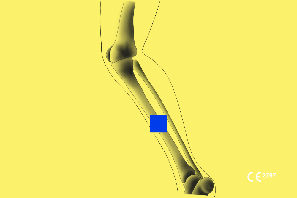Boneview Ai