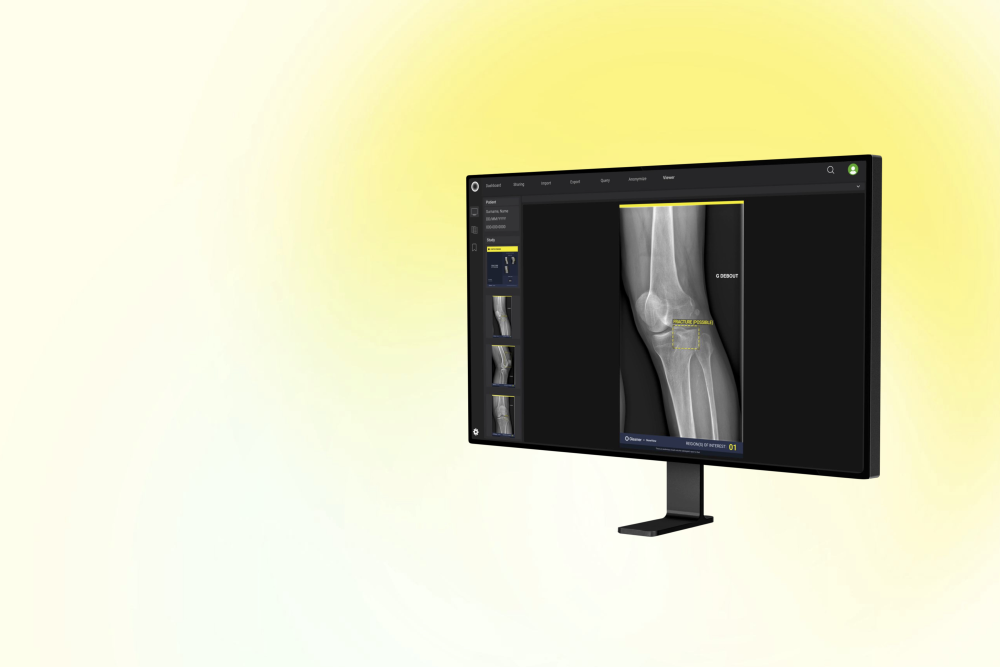 Boneview Hero