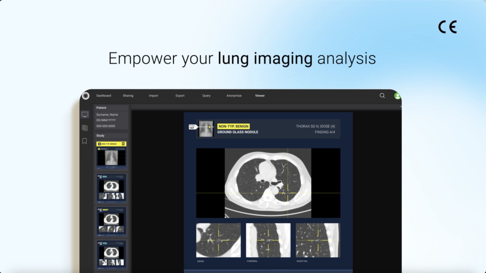 Lungct Thumbnail