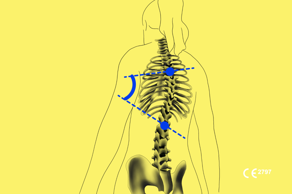 Bonemetric Ok Pdf